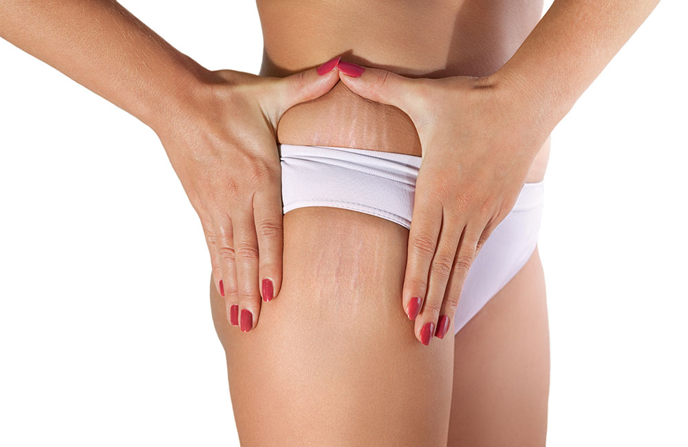 Mesotherapie